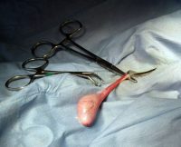 Male Dog's Neutering ( Orchidectomy - Castration )