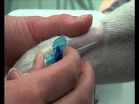 Cannulation | تركيب كانيولا