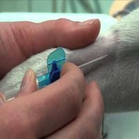 Cannulation | تركيب كانيولا