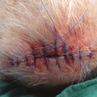 Wound Suturing