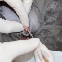 Urinary Catheterization | تركيب قسطرة بولية