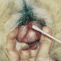 Vaginal Smear + Microscopic Exam